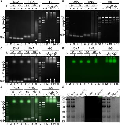 Efficient Detection of Long dsRNA in Vitro and in Vivo Using the dsRNA Binding Domain from FHV B2 Protein